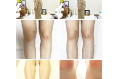 奈良県奈良市 さくら整体院 整体 小顔矯正 骨盤矯正 ダイエット マッサージ