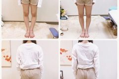 奈良県奈良市 さくら整体院 整体 小顔矯正 骨盤矯正 ダイエット マッサージ