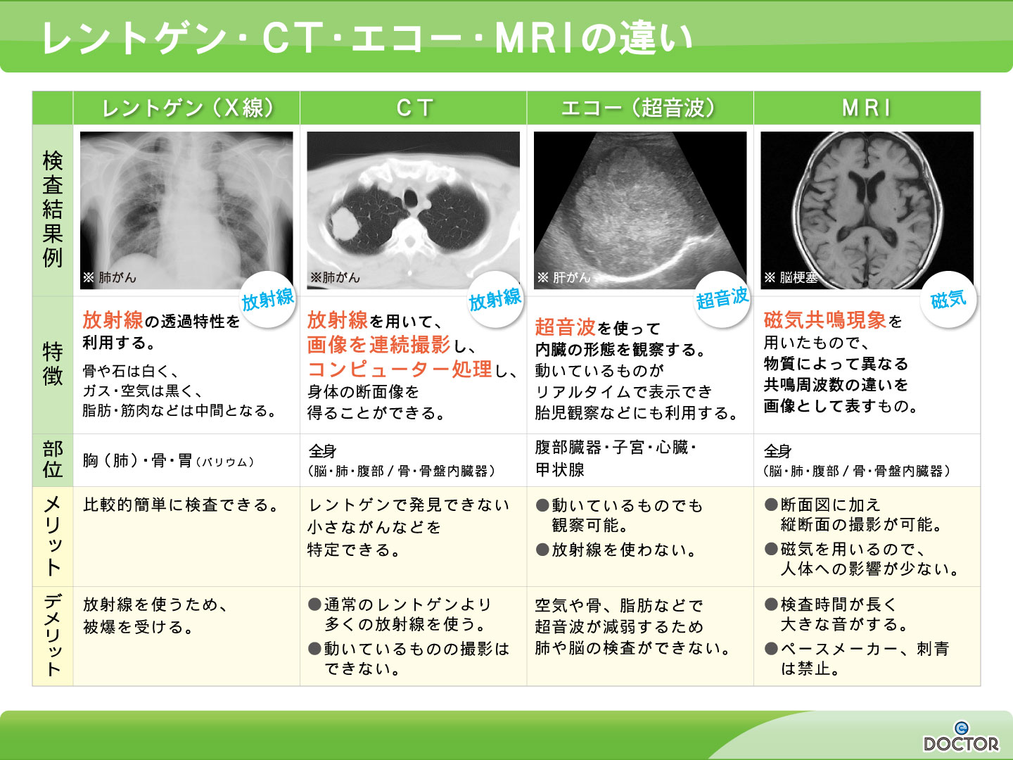 レントゲン・CT・エコー・MRIの違い