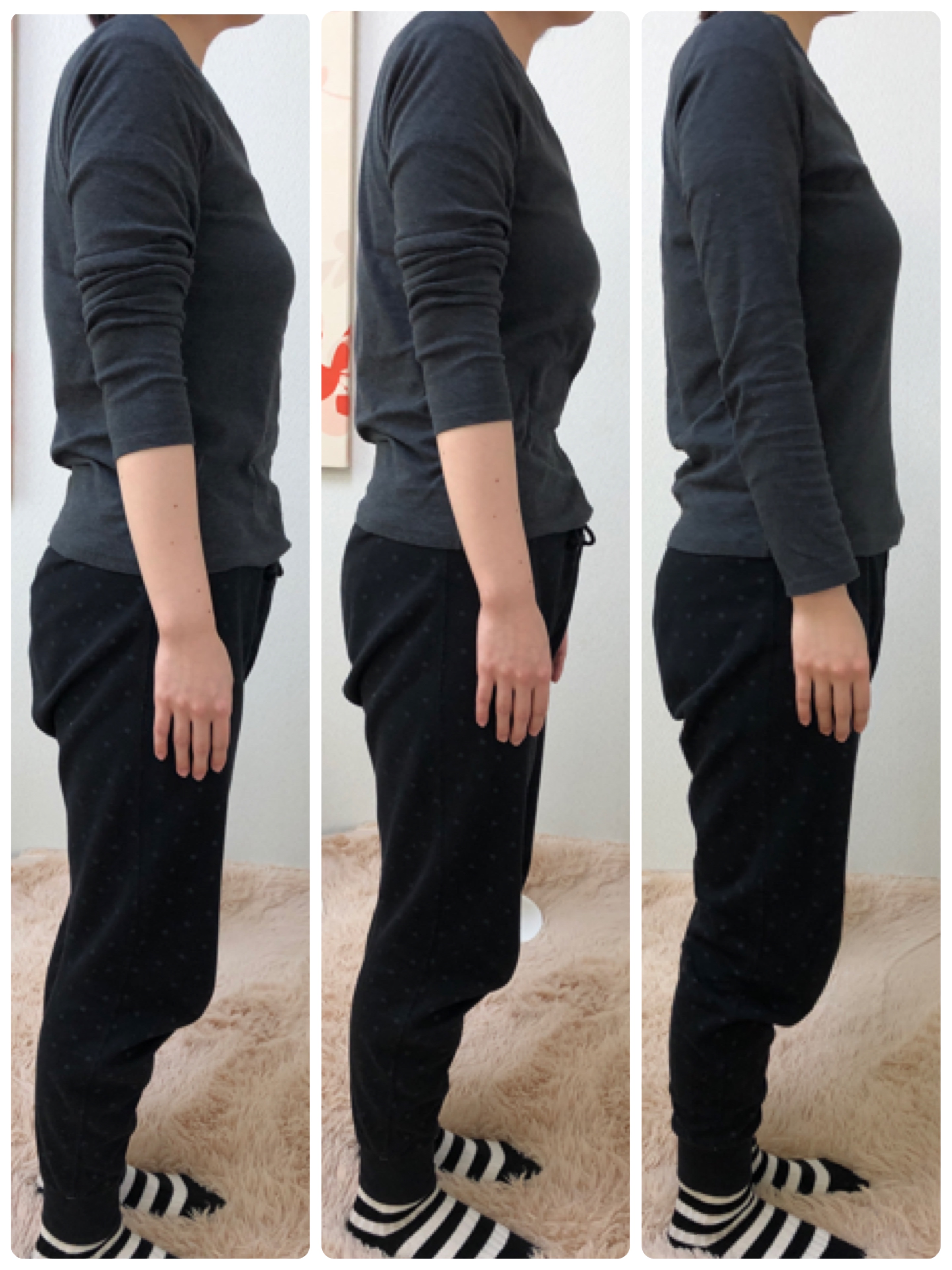 側湾と姿勢改善の3段階経過写真｜さくら整体院 奈良