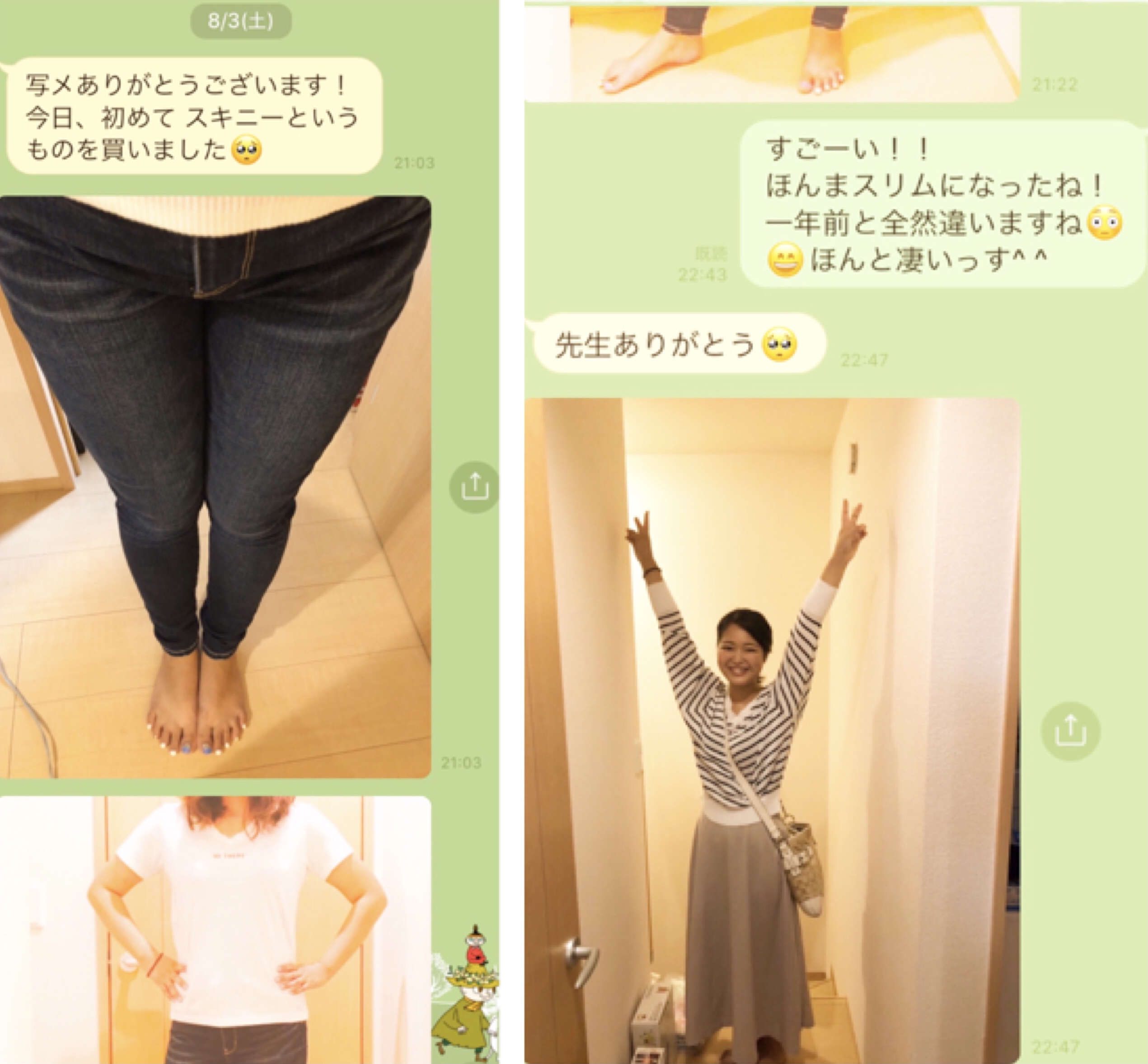 奈良市 美容整体 骨盤矯正ダイエット ビフォーアフター