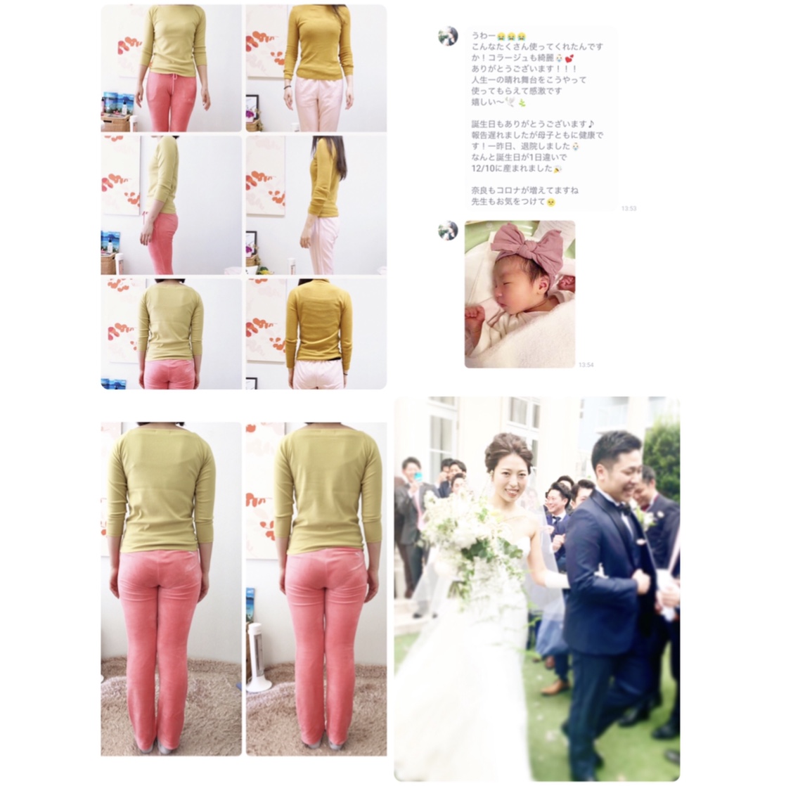 骨盤矯正ダイエットのビフォーアフター症例写真｜さくら整体院 奈良