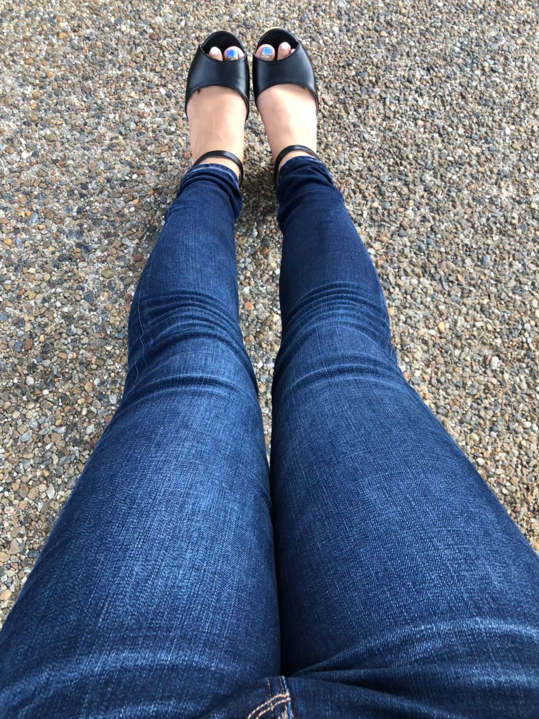 O脚矯正と脚ライン改善の経過写真 7｜さくら整体院 奈良