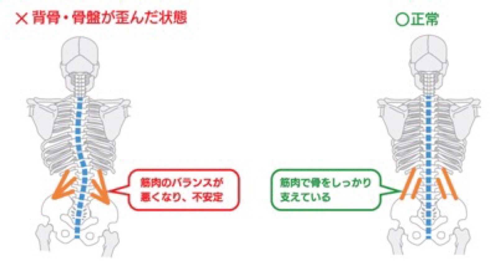 奈良県奈良市｜整体 猫背 反り腰 骨盤矯正 マッサージ 小顔矯正