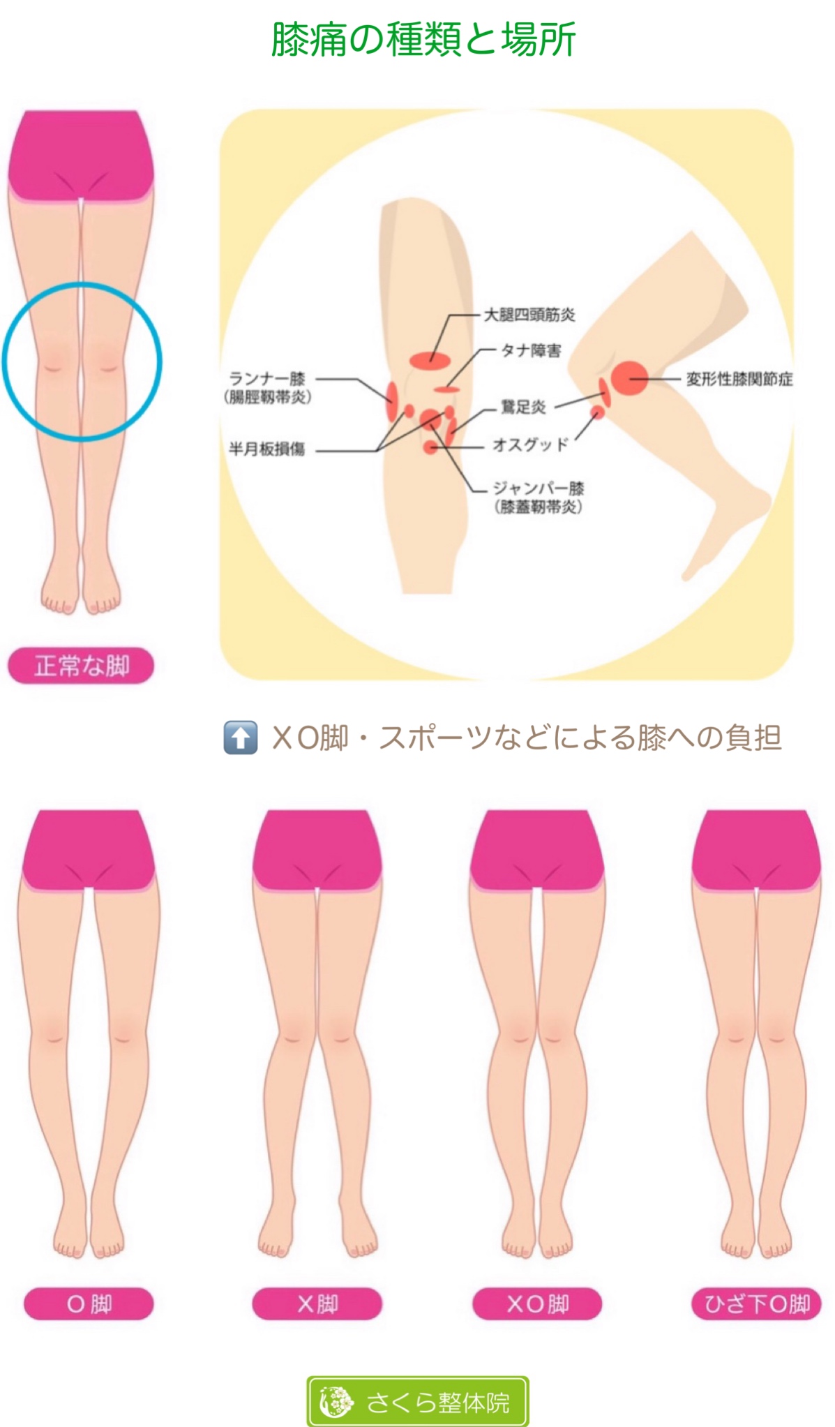 奈良市 バレエ さくら整体院 O脚 膝痛