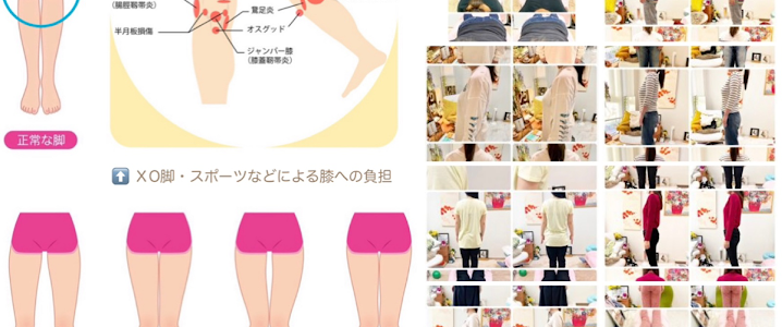腰痛・膝痛・美脚O脚矯正