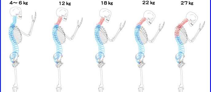 奈良県奈良市姿勢矯正2