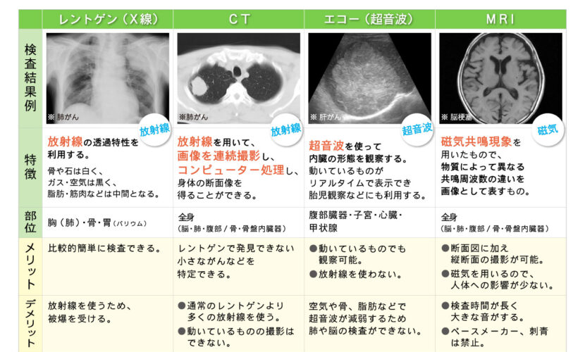 レントゲン・CT・エコー・MRI