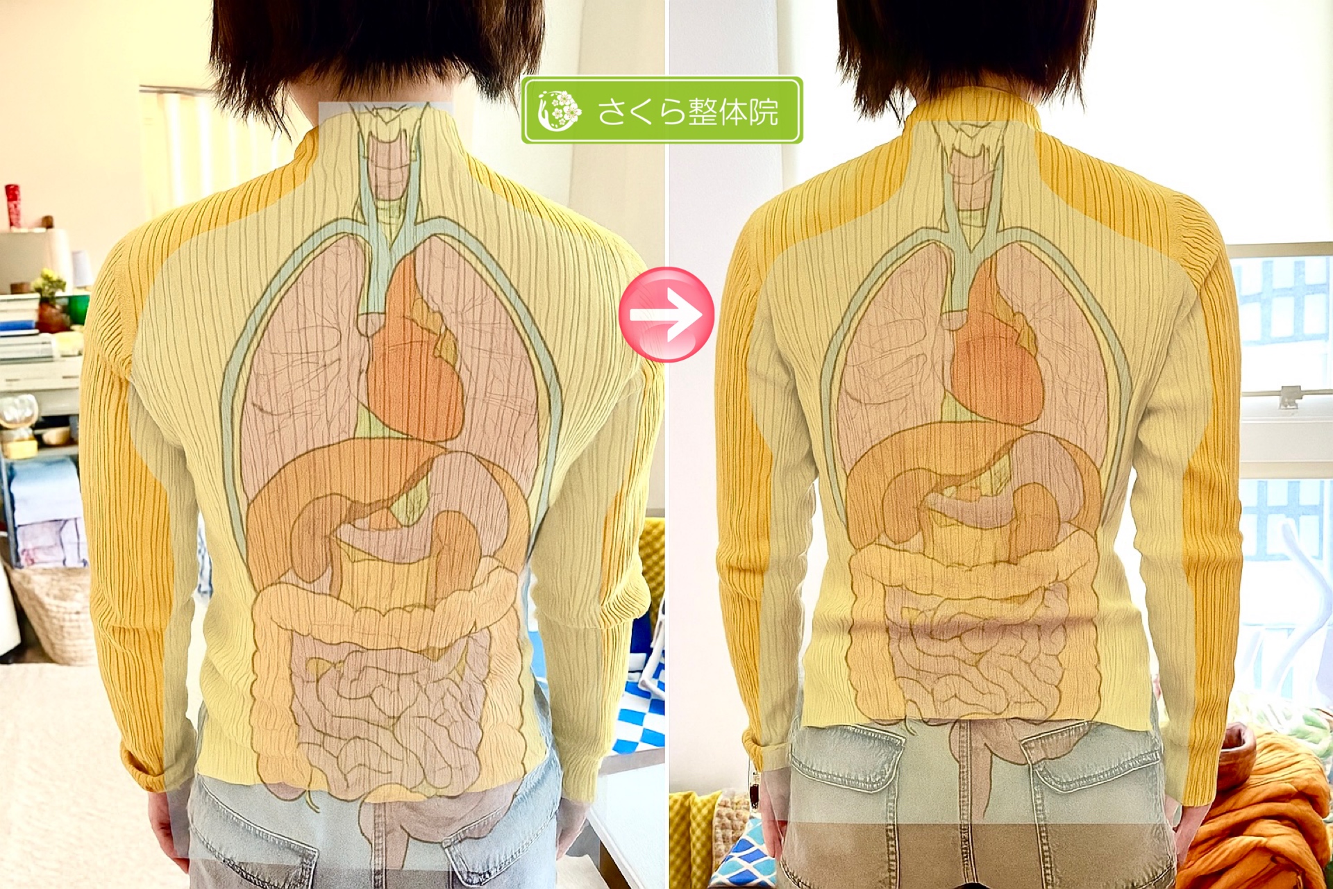 体の歪み整体