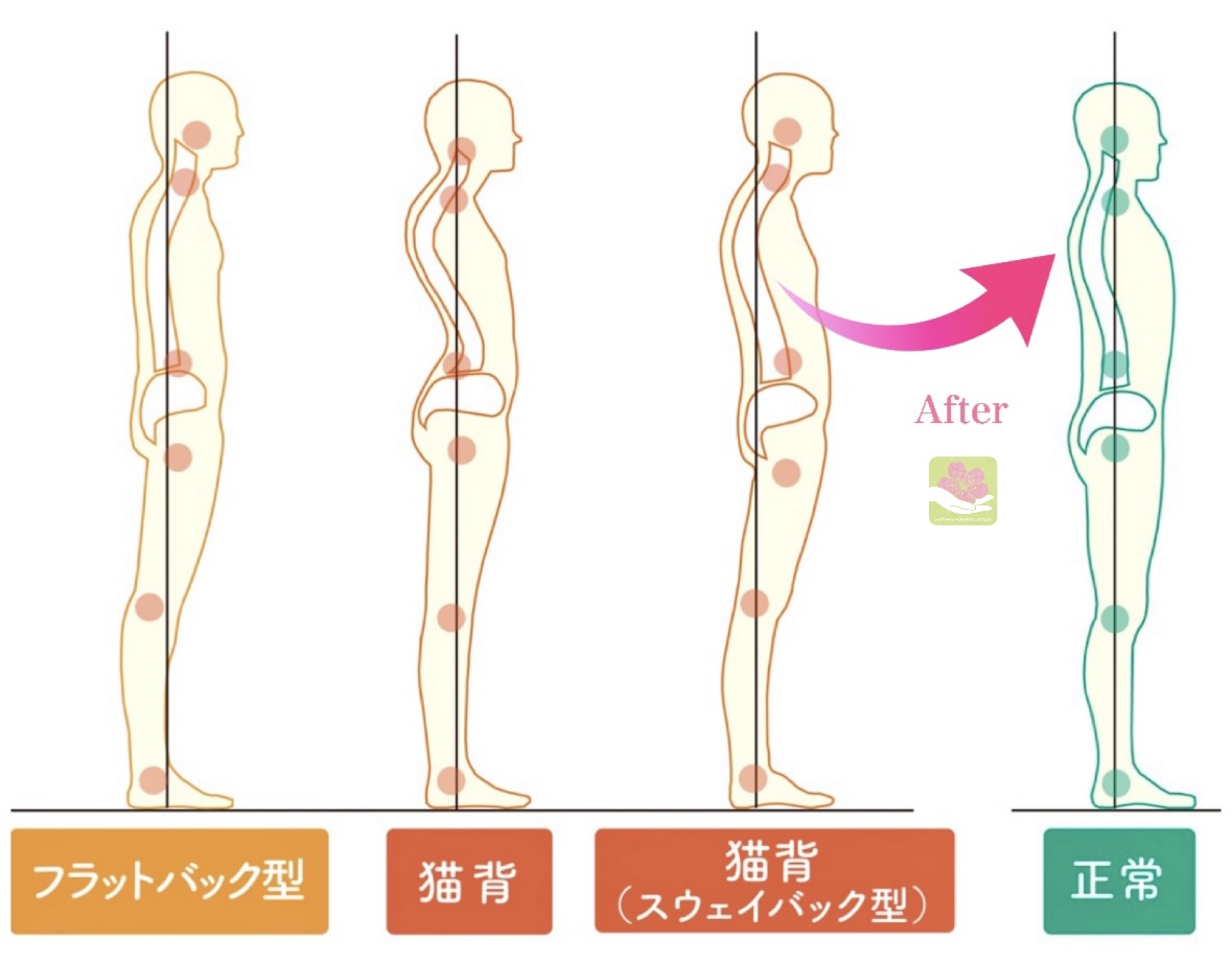 奈良市整体骨盤矯正