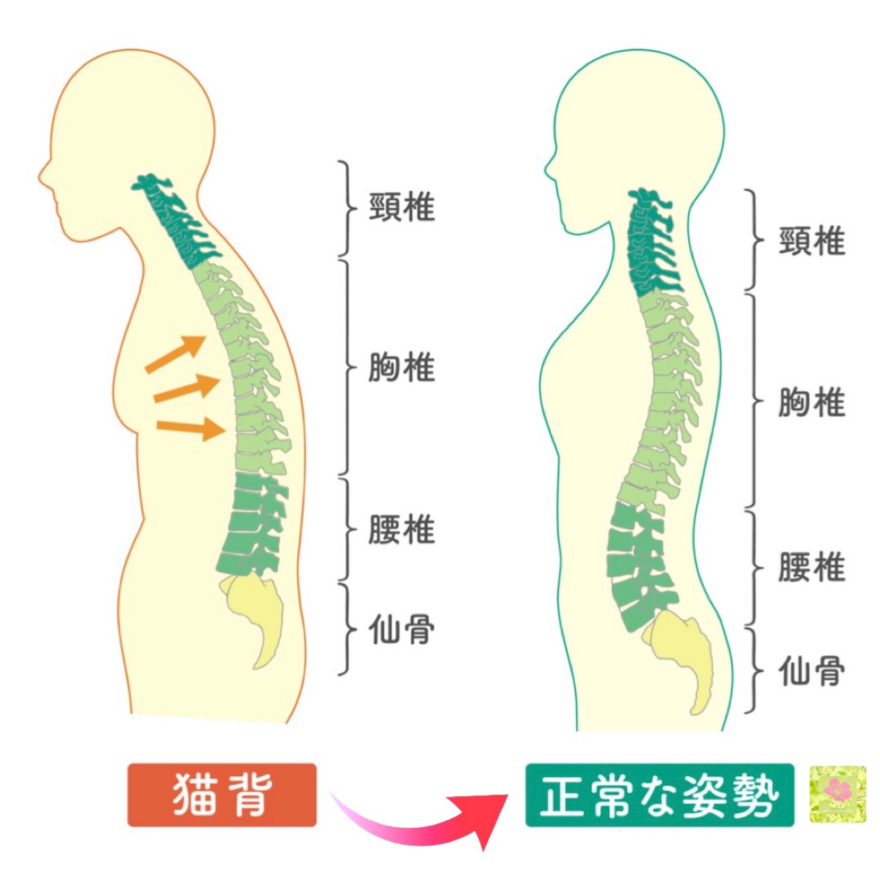 奈良市猫背姿勢矯正 » 奈良市 整体|さくら整体院 JR奈良駅→3分 骨盤矯正ダイエット+小顔矯正 カイロプラクティック整体院 奈良市猫背姿勢矯正