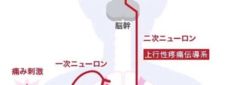 ゲートコントロール理論