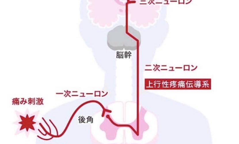 ゲートコントロール理論