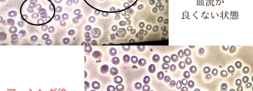 アーシング効果