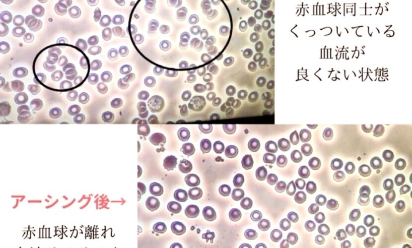 アーシング効果