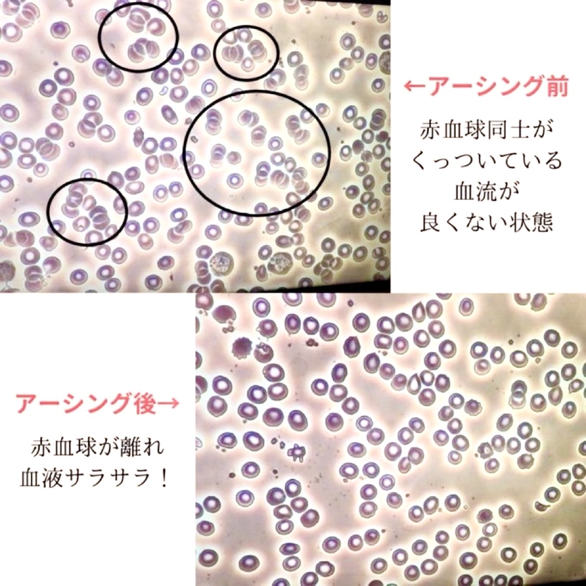 アーシング効果