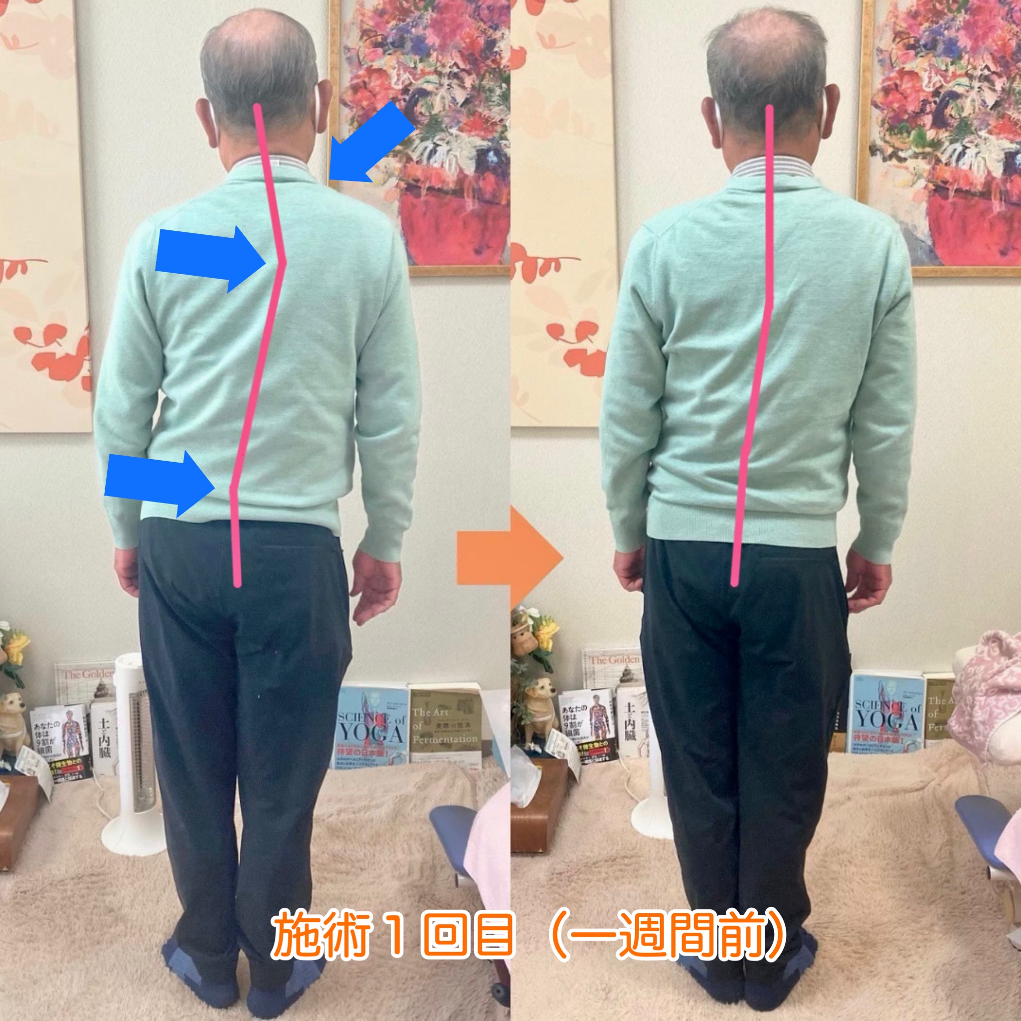IMG_5461 » 奈良市 整体|さくら整体院 JR奈良駅→3分 骨盤矯正ダイエット+小顔矯正 カイロプラクティック整体院