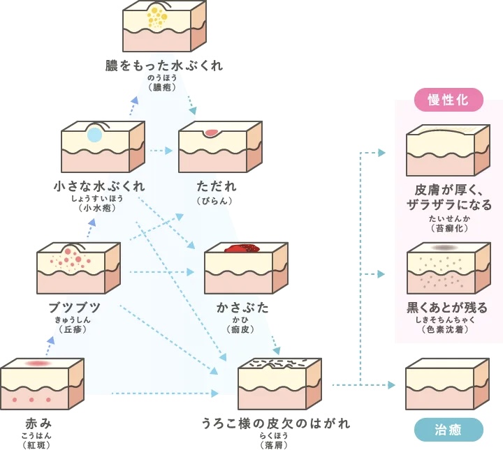 奈良市病院皮膚科