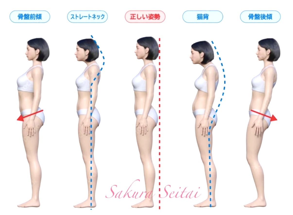 姿勢改善・骨盤矯正|奈良市さくら整体院 » 奈良市の整体 さくら整体院 姿勢改善・骨盤矯正|奈良市さくら整体院