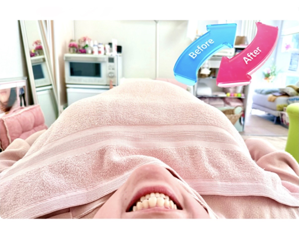 奈良市バストアップ