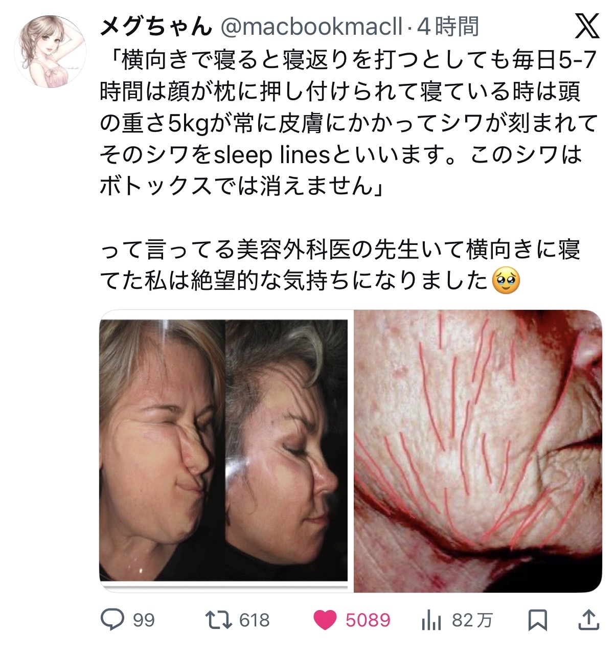 奈良市シワ歪み