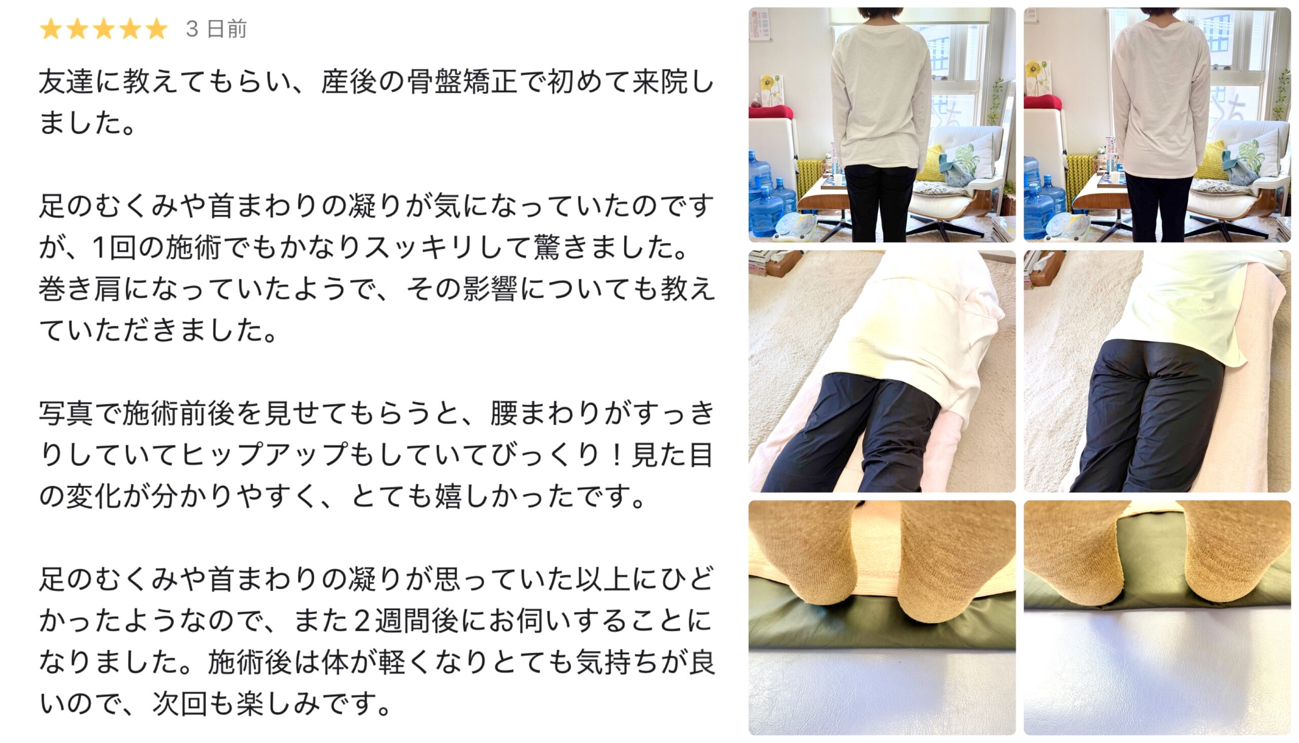 Japanese patient testimonial page about postpartum pelvic correction; collage of standing back view and treatment-area photos in a clinic.